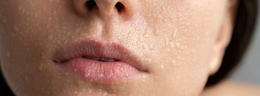 Monsoon acne woes: Your ultimate guide to clear skin